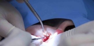 Labrović: Prodajem komadić svoje kože na e-bayu