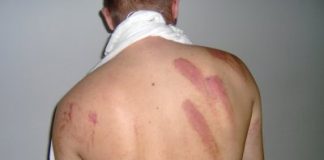 ´Policija je mlatila sve – Boyse, žene i djecu´