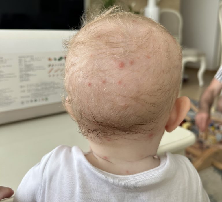 Vodene kozice – sve što trebate znati o njima