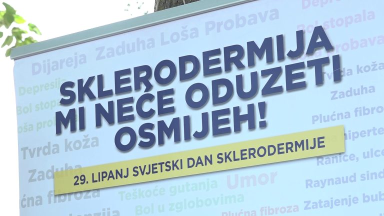 Znate li što je sklerodermija?