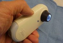 Raspored besplatnih pregleda ranog otkrivanja melanoma u Zagrebačkoj županiji melanom pregled madeža